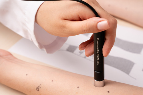 Corneometer® CM 825